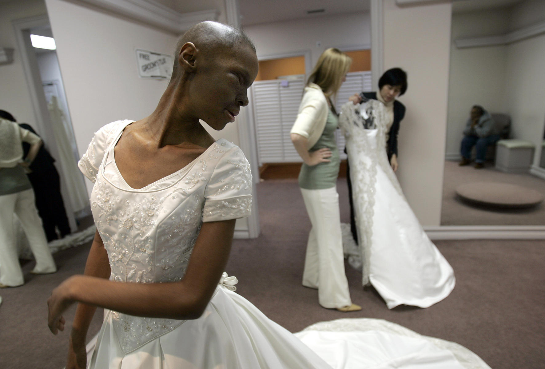 Cancer victim tries on her wedding dress, Escondido CA